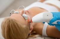 Co2 Laser Resurfacing